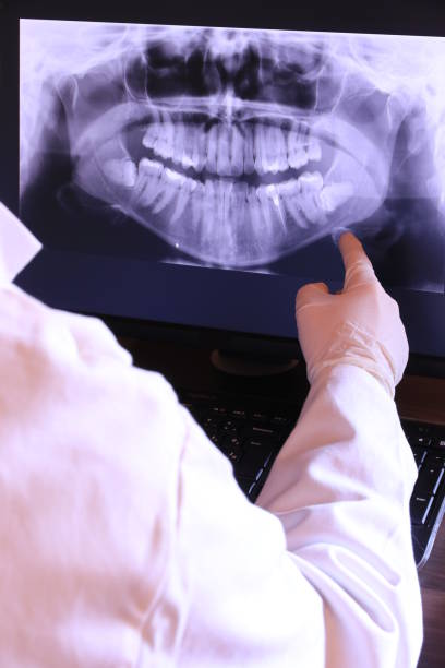Best Emergency Wisdom Tooth Extraction in Chatfield, MN